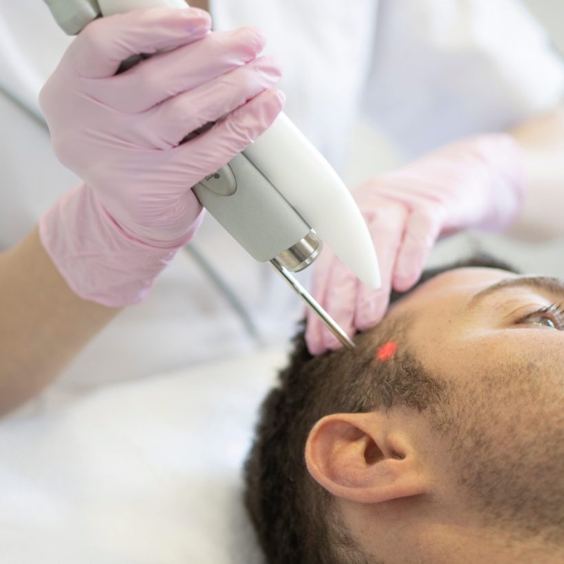 Doctor,Female,Dermatologist,Trichologist,Makes,A,Procedure,To,Stimulate,Hair